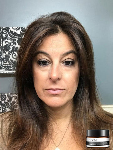 YouthGaze™ Rapid Revive Oogcrème