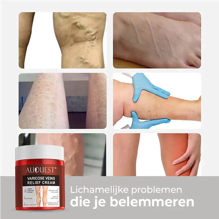 VeinCare Naturals | Crème voor verlichting van spataderen
