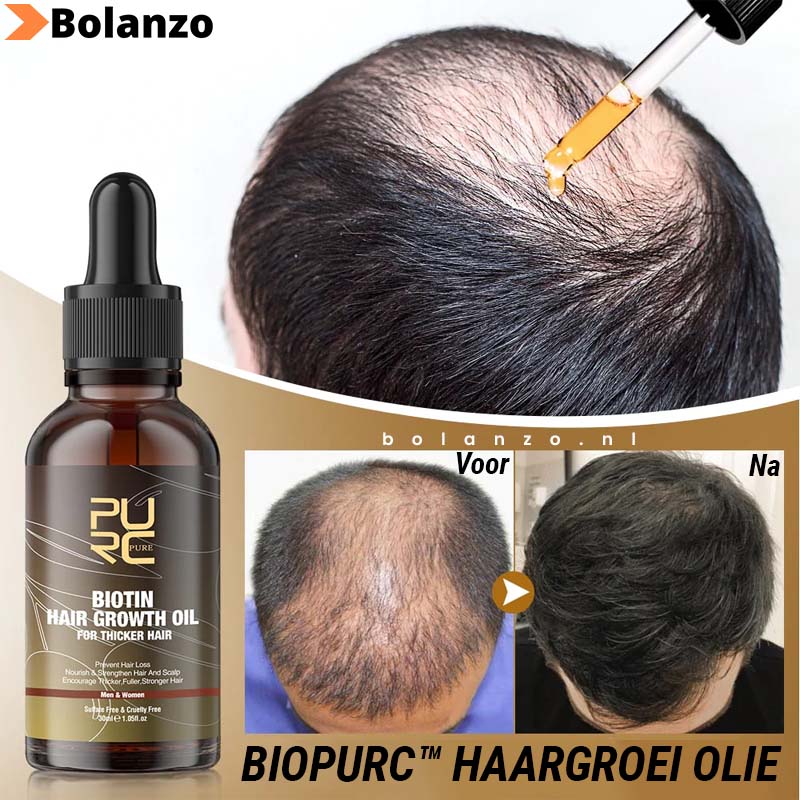 BioPurc™ Haargroei olie (1+1 Gratis)