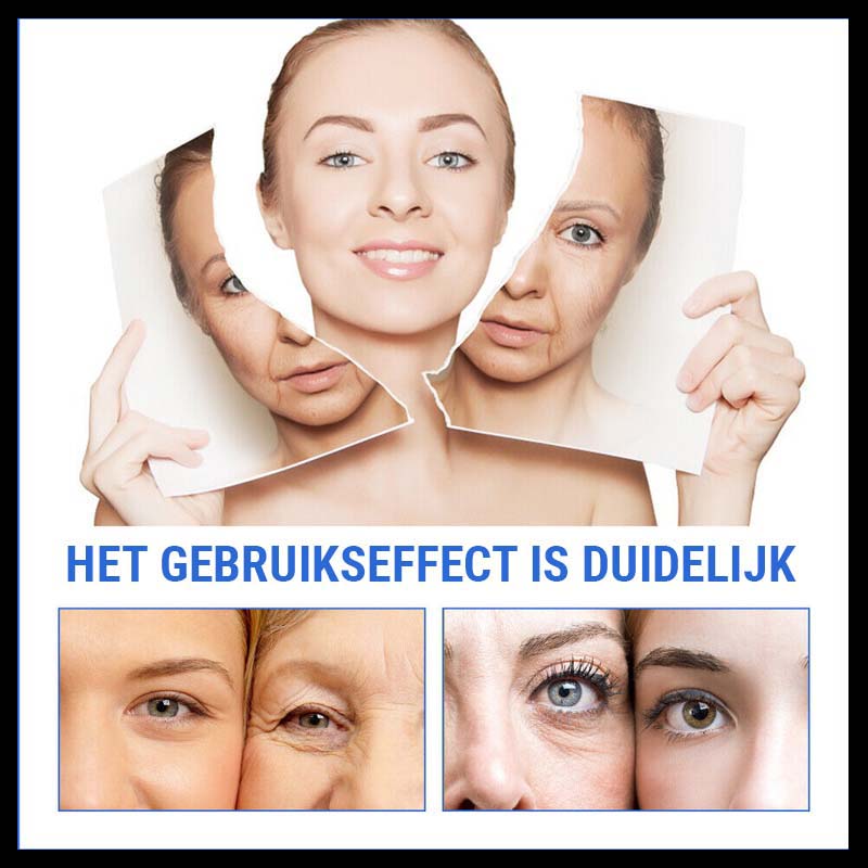 YouthfulBloom™ - Botoxserum tegen veroudering (1+1 Gratis)