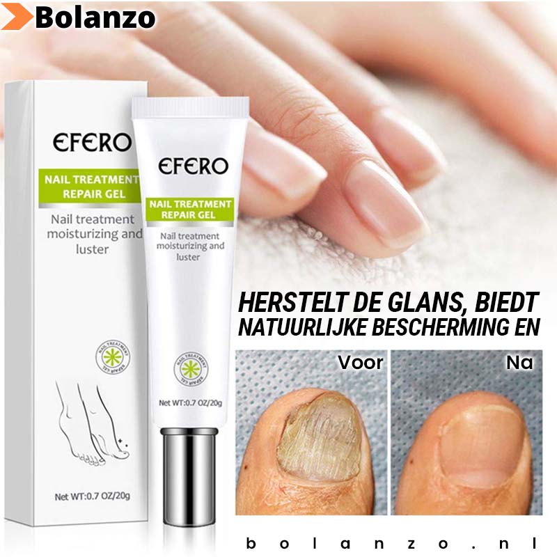 1+1 Gratis | Fungus Repair™️ | Weg met nagelschimmel