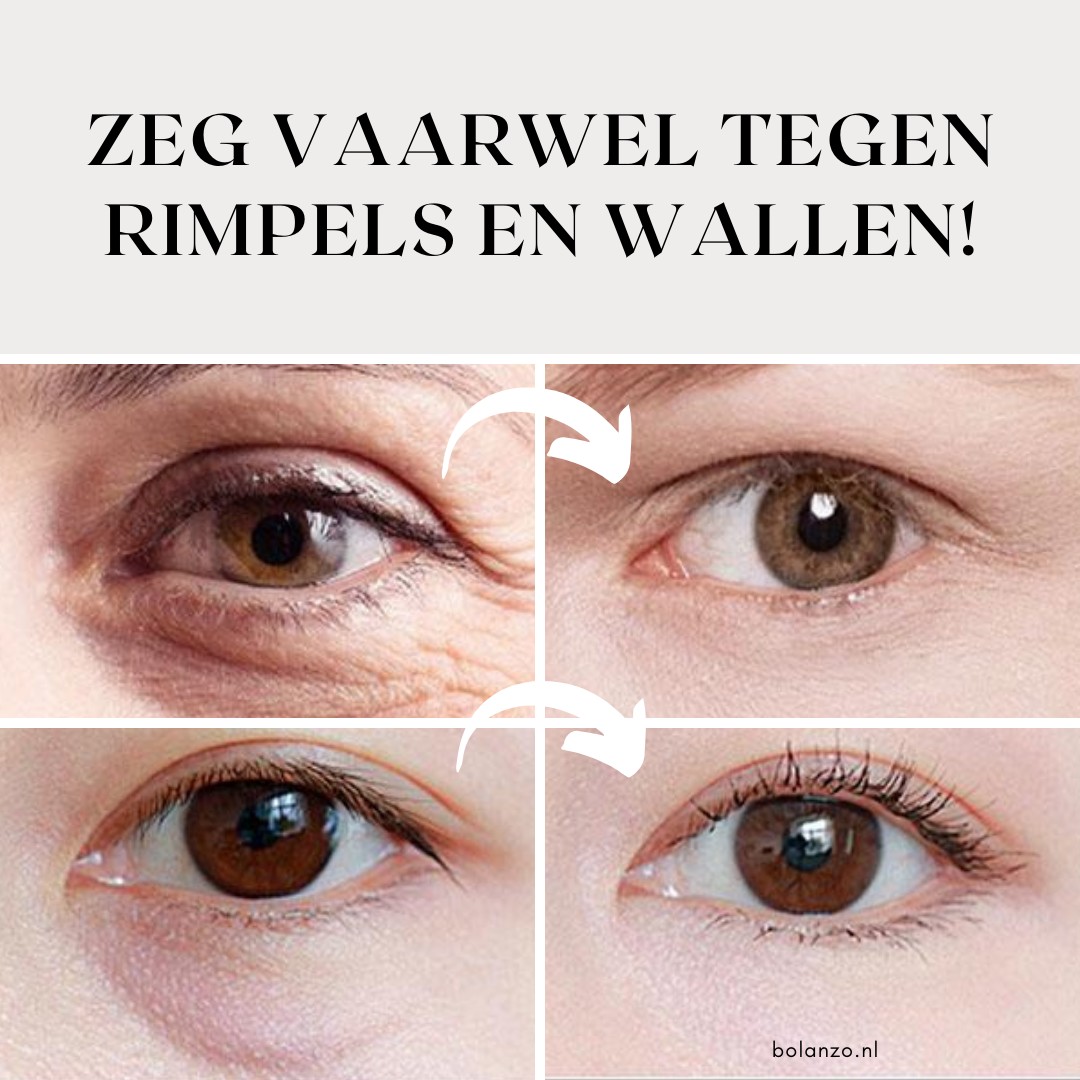 Youthy™ - Oogverstevigende crème