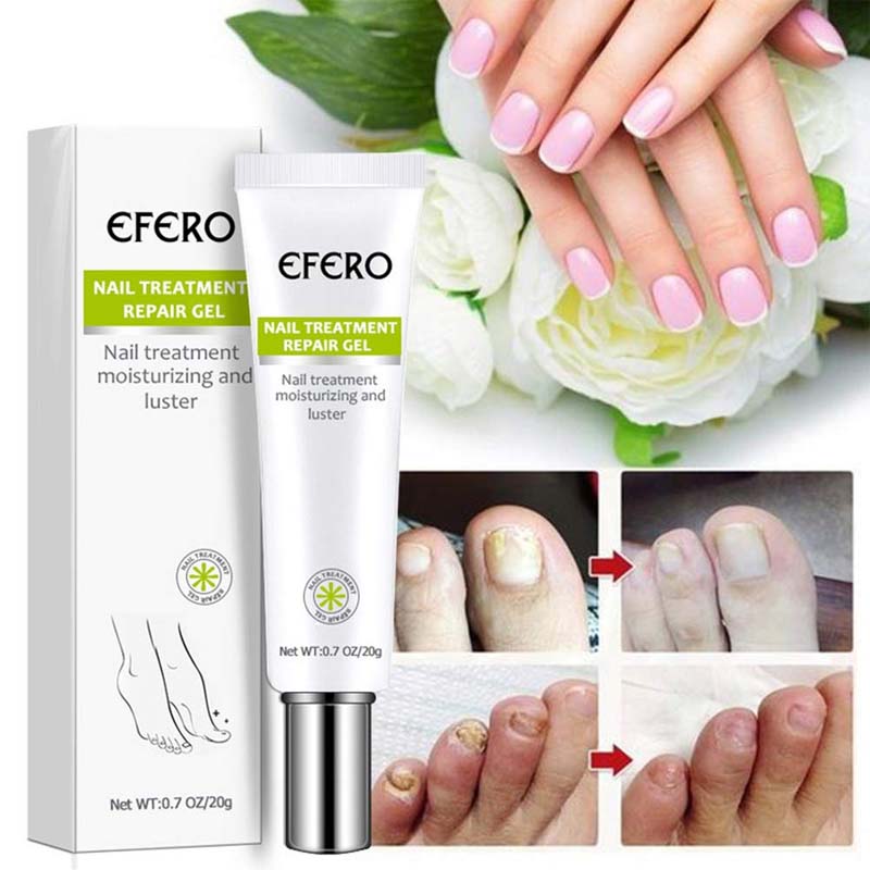 1+1 Gratis | Fungus Repair™️ | Weg met nagelschimmel