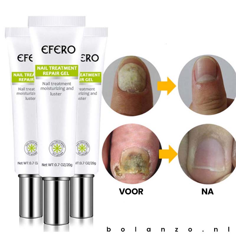 1+1 Gratis | Fungus Repair™️ | Weg met nagelschimmel