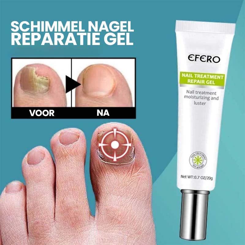 1+1 Gratis | Fungus Repair™️ | Weg met nagelschimmel