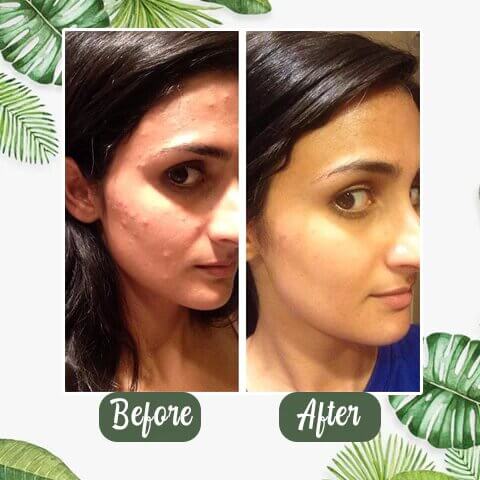 Glowbeauty™ Groene Thee Masker