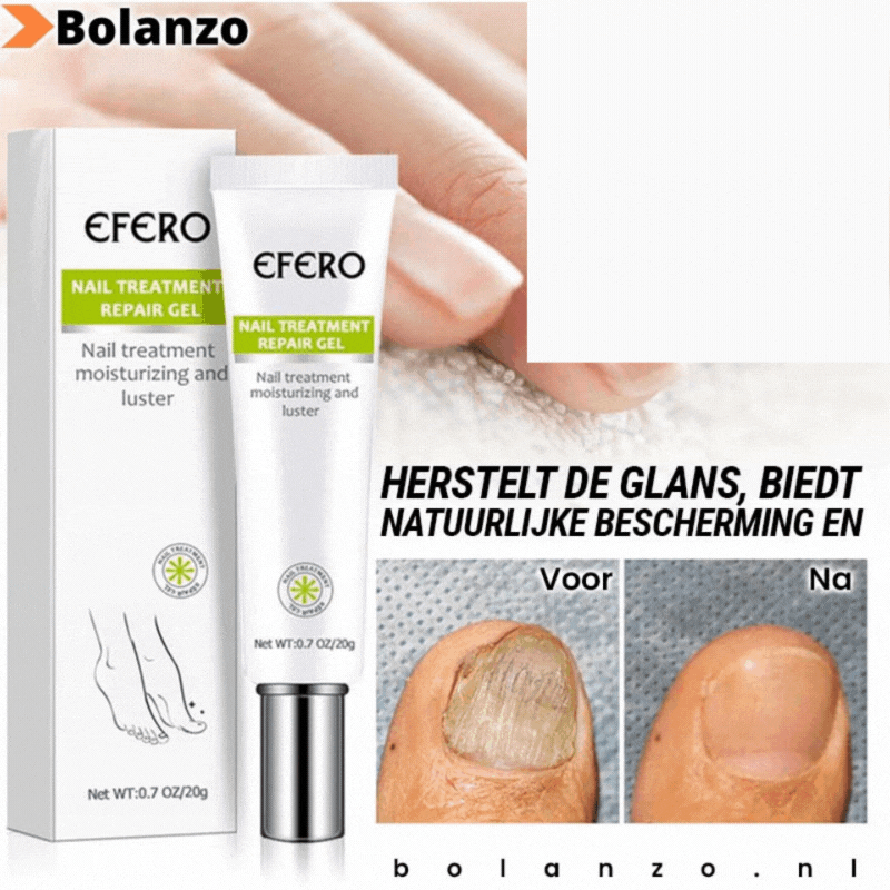 1+1 Gratis | Fungus Repair™️ | Weg met nagelschimmel