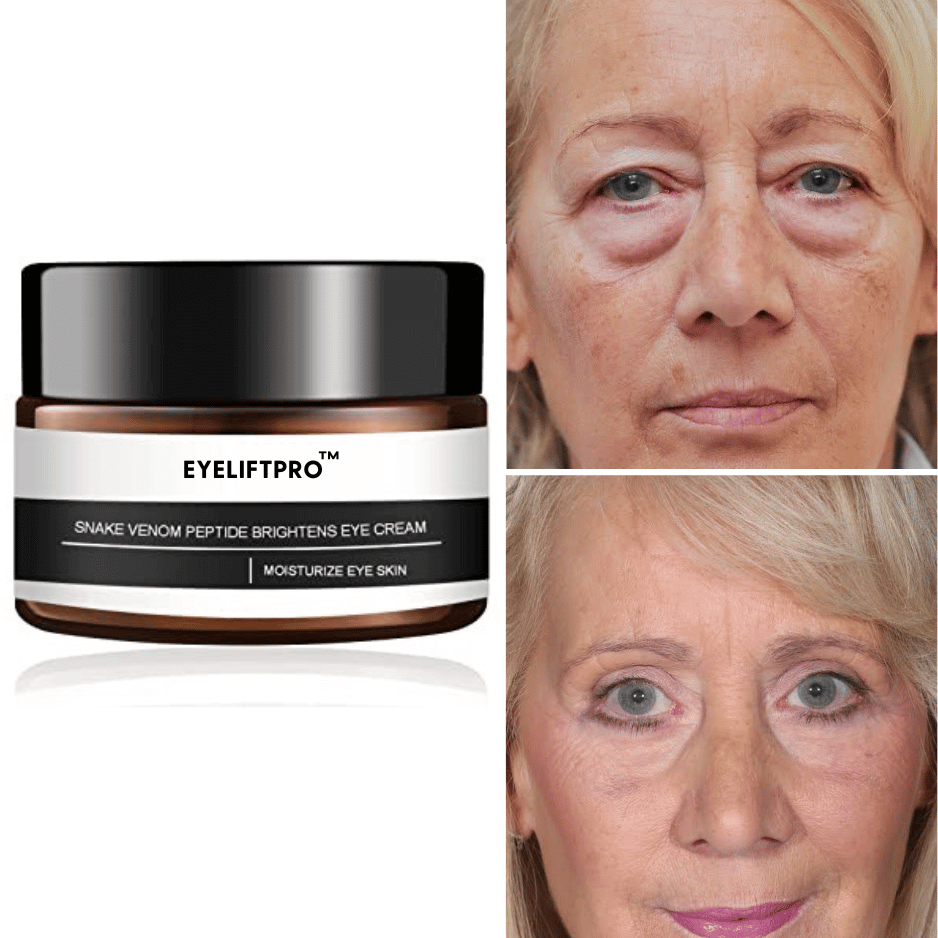 Youthy™ - Oogverstevigende crème