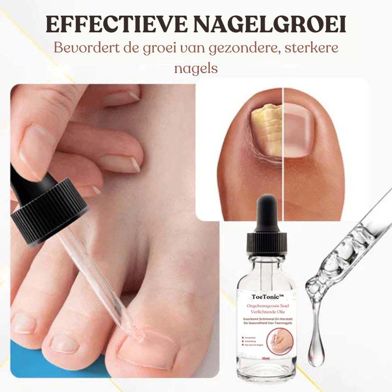 ToeTonic™ Nagel Herstel Serum