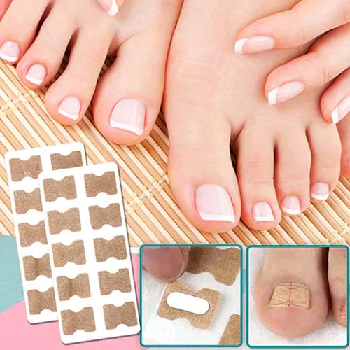 EasyPlaster™ | Corrigerende pleisters voor mooie en gezonde nagels | 25 + 25 Gratis