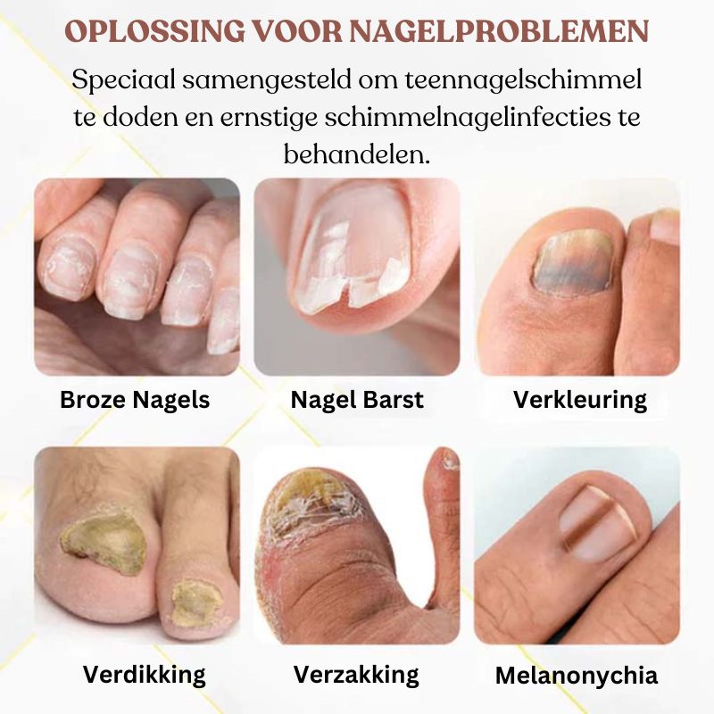 ToeTonic™ Nagel Herstel Serum