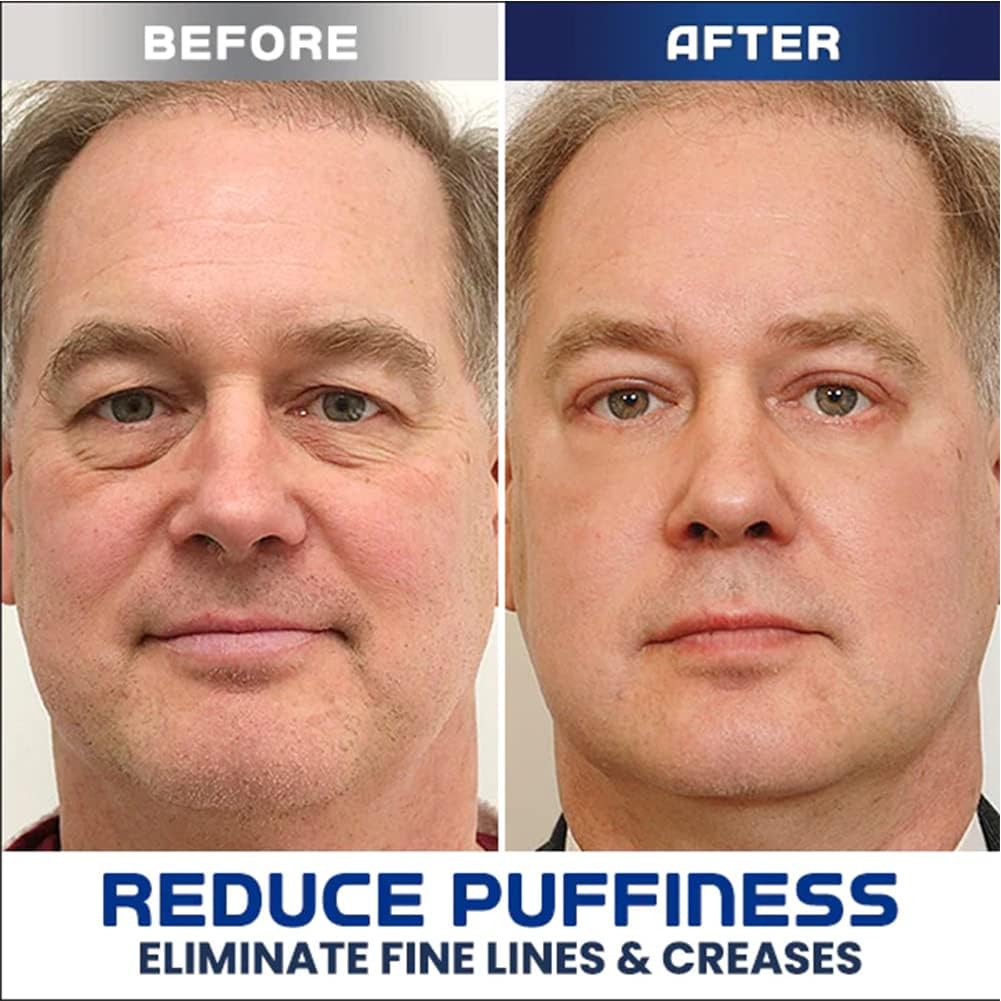 AgelessEyes™ Peptide liftende gel