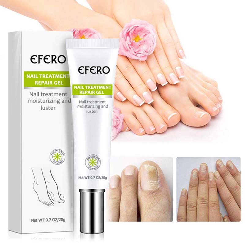 1+1 Gratis | Fungus Repair™️ | Weg met nagelschimmel