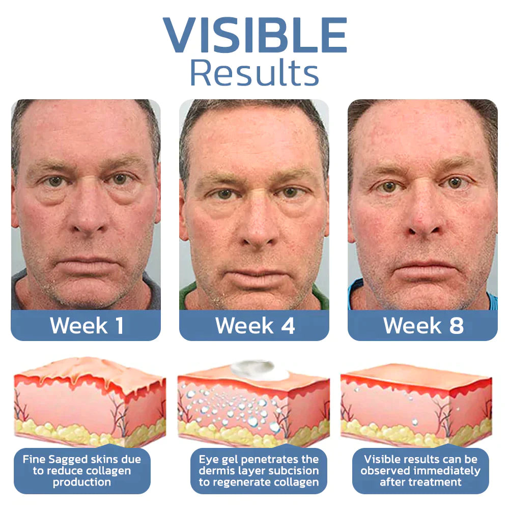 AgelessEyes™ Peptide liftende gel