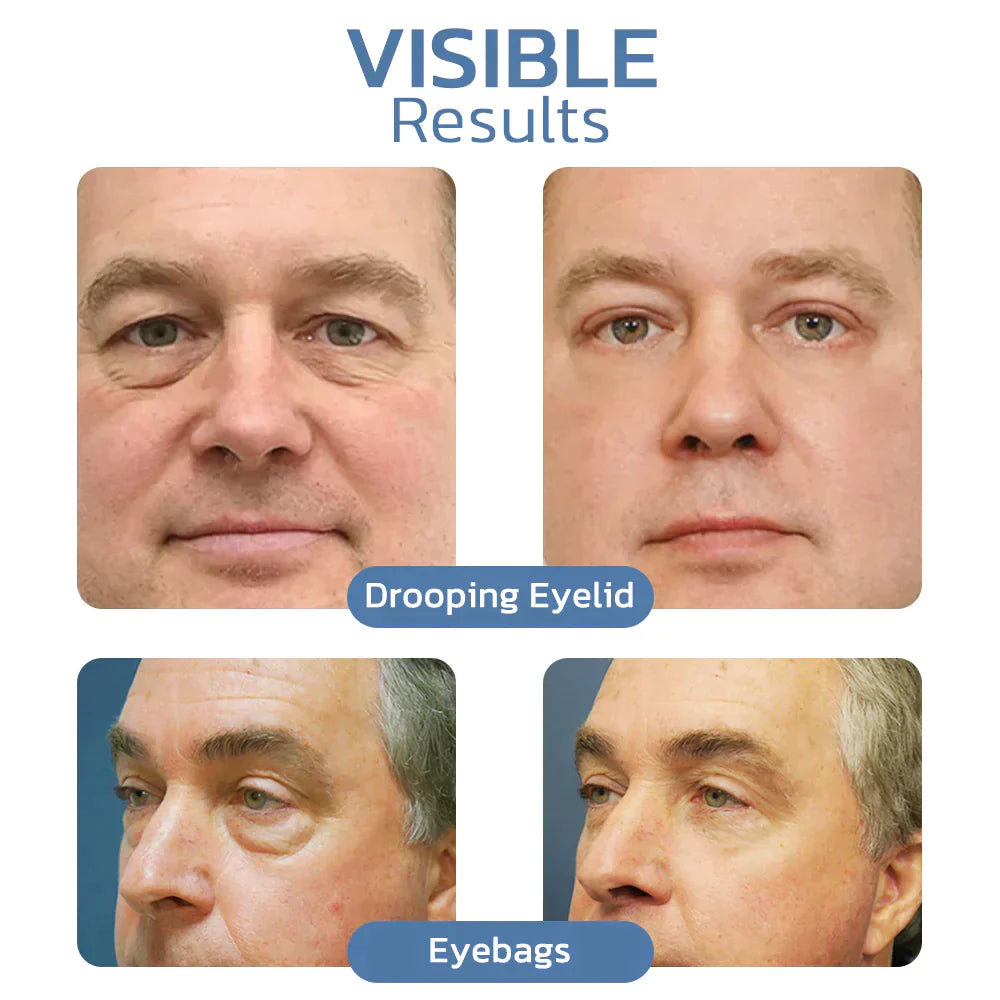 AgelessEyes™ Peptide liftende gel