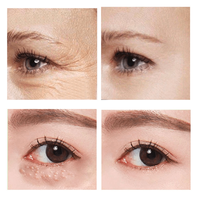 YouthGaze™ Rapid Revive Oogcrème