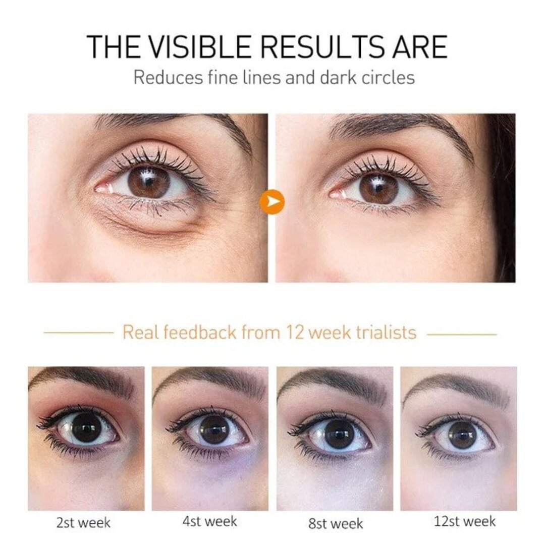 BrightEye® | Anti Aging & Wrinkle Removing Eye Cream