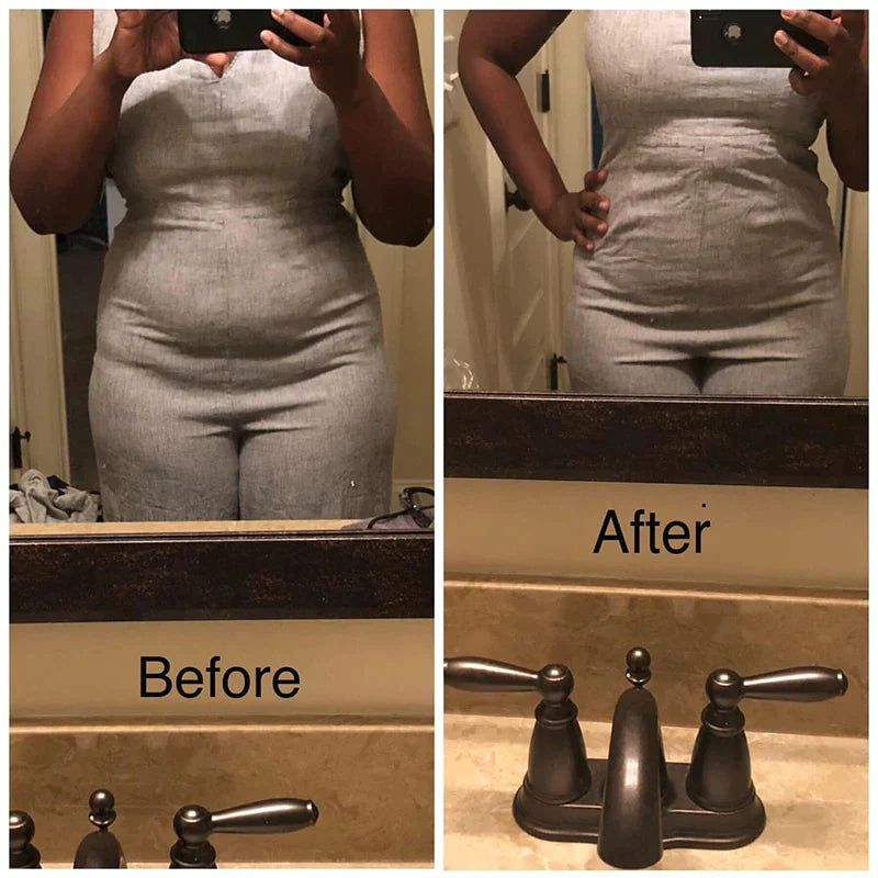 Tummy Shaper™ - Feel slim and elegant